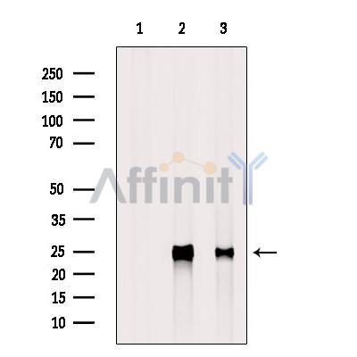 IL6 Antibody - Western blot analysis of extracts from various samples, using IL-6 Antibody.