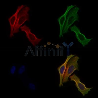 NCK1 Antibody - DF6181 staining Hela cells by IF/ICC.