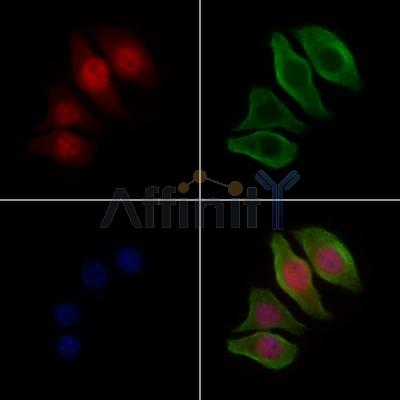 XPA Antibody - DF6513 staining Hela cells by IF/ICC.