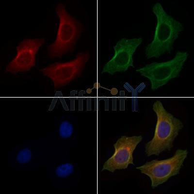 SLC22A5 Antibody - DF6549 staining HepG2 cells by IF/ICC.