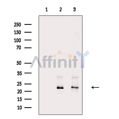 RAB27A Antibody - Western blot analysis of extracts from various samples, using RAB27A Antibody.