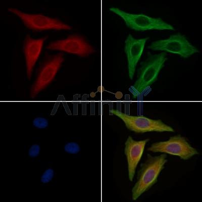 EIF5A1 Antibody - DF6754 staining HepG2 cells by IF/ICC.