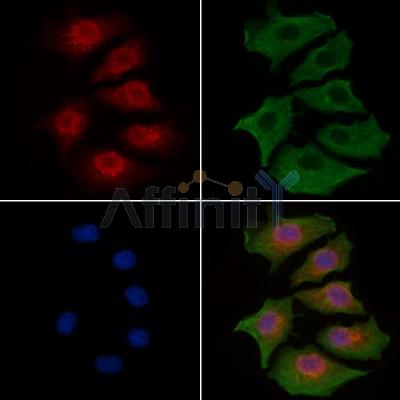 ILF3 Antibody - DF6965 staining HepG2 cells by IF/ICC.