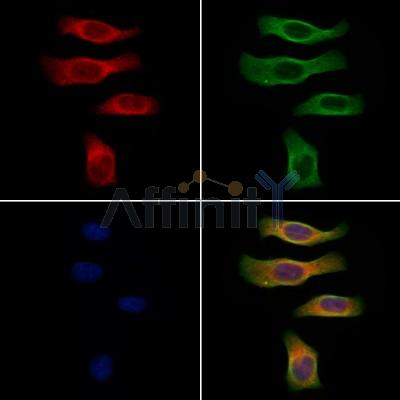 CALCA Antibody - DF7386 staining Hela cells by IF/ICC.