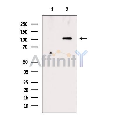 EPS15L1 Antibody - Western blot analysis of extracts from Rat lung, using EPS15L1 Antibody.