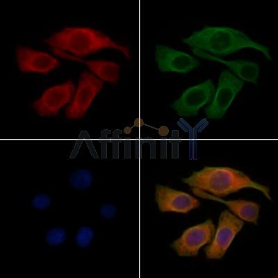 IGFBP2 Antibody - DF7765 staining Hela cells by IF/ICC.