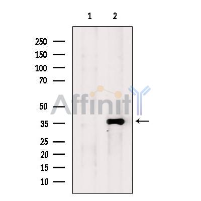 SIRT4 Antibody - Western blot analysis of extracts from Mouse  brain, using SIRT4 Antibody.