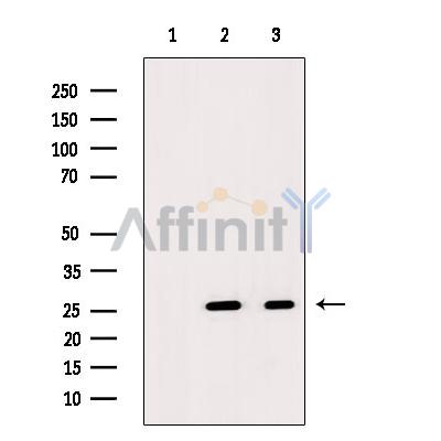 Defensin  alpha 4 Antibody - Western blot analysis of extracts from various samples, using Defensin  alpha4 Antibody.