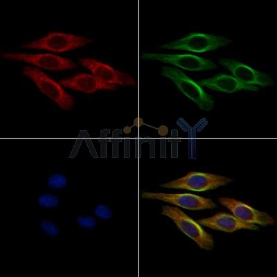 Tensin-1 Antibody - DF8622 staining HepG2 cells by IF/ICC.