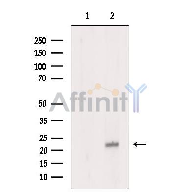 APOBEC3C Antibody - Western blot analysis of extracts from A2780 cells, using APOBEC3C Antibody.
