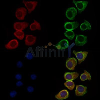 MAGEB1 Antibody - DF9016 staining HepG2 cells by IF/ICC.