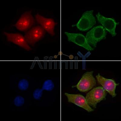 MAGB4 Antibody - DF9017 staining HepG2 cells by IF/ICC.