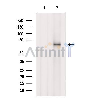 ACAD11 Antibody - Western blot analysis of extracts from Hela cells, using ACAD11 Antibody.