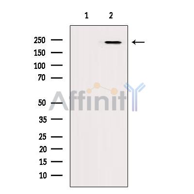 ADAMTS9 Antibody - Western blot analysis of extracts from 293, using ADAMTS9 Antibody.