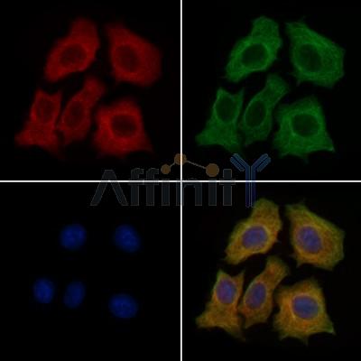 AQP11 Antibody - DF9222 staining HepG2 cells by IF/ICC.