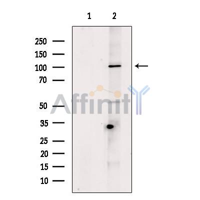 DSG3 Antibody - Western blot analysis of extracts from Rat  kidney, using DSG3 Antibody.