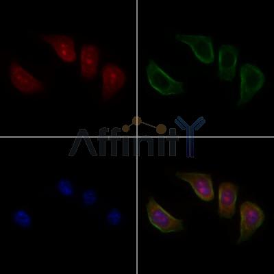 FNBP4 Antibody - DF9521 staining Hela cells by IF/ICC.