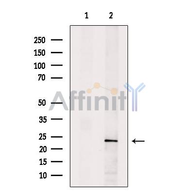 PTGDS2 Antibody - Western blot analysis of extracts from A2780 cells, using PTGDS2 Antibody.