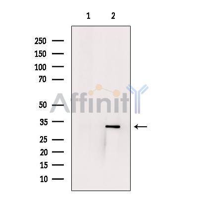 MED4 Antibody - Western blot analysis of extracts from VERO cells, using MED4 Antibody.