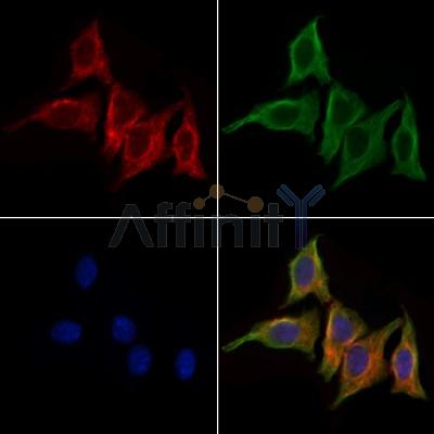 RAB39A Antibody - DF9828 staining HepG2 cells by IF/ICC.
