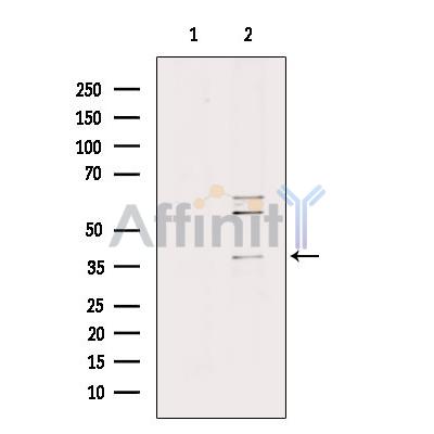 RAB39A Antibody - Western blot analysis of extracts from EC304 cells, using RAB39A Antibody.
