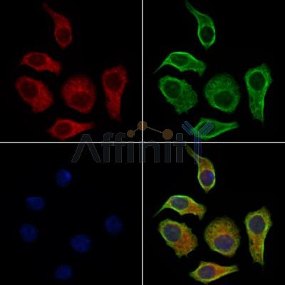 RAB39B Antibody - DF9829 staining HepG2 cells by IF/ICC.