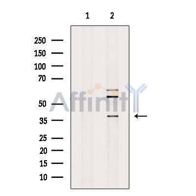 RAB39B Antibody - Western blot analysis of extracts from EC304 cells, using RAB39B Antibody.
