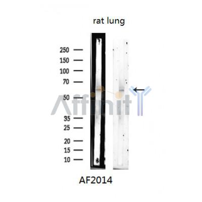 Phospho-Chk1 (Ser280) Antibody - Western blot analysis of extracts from Rat lung, using Phospho-Chk1 (Ser280) Antibody.