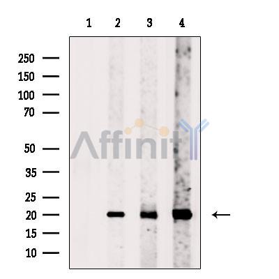 Tim23 Antibody - Western blot analysis of extracts from various samples, using Tim23 Antibody.