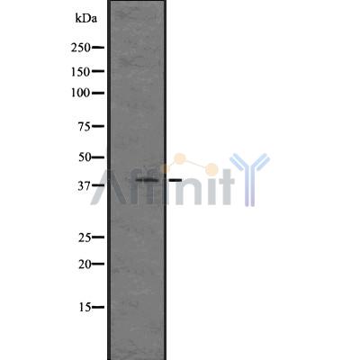 MAS Antibody - Western blot analysis of MAS expression in  Human fetal liver lysates .