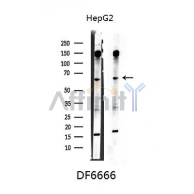 DKC1 Antibody - Western blot analysis of extracts from HepG2 cells, using DKC1 Antibody.