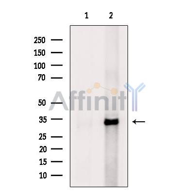 SLC25A4 Antibody - Western blot analysis of extracts from Rat kidney, using SLC25A4 Antibody.