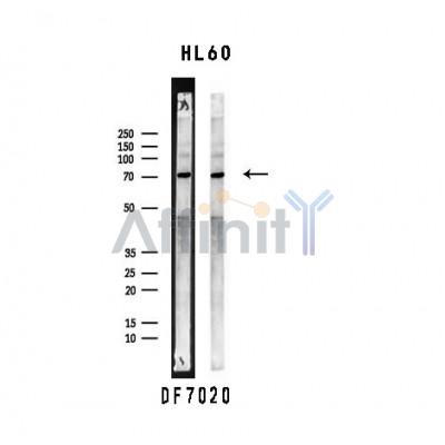 SLP76 Antibody - Western blot analysis of extracts from HL60 cells, using LCP2 Antibody.