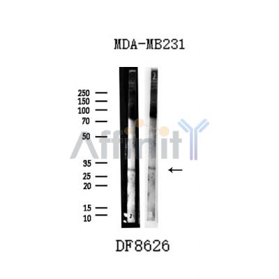 UCP2 Antibody - Western blot analysis of extracts from MDA-MB-231 cells, using UCP2 Antibody.
