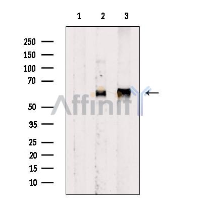 Phospho-Src (Tyr527)[Tyr530] Antibody - Western blot analysis of extracts from 293 cells/COS-7 cells, using Phospho-Src (Tyr530) Antibody.