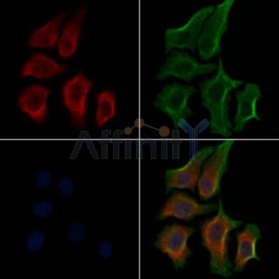 Phospho-RPS6 (Ser235) Antibody - AF3354 staining HepG2 cells(30min of 4uM Forskolin treatment) by IF/ICC.