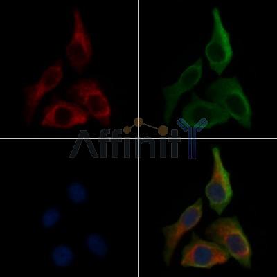 N Cadherin Antibody - AF4039 staining HepG2 cells(30min of 4uM Forskolin treatment) by IF/ICC.