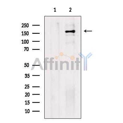 TSC1 Antibody - Western blot analysis of extracts from COS-7 cells, using TSC1 Antibody.