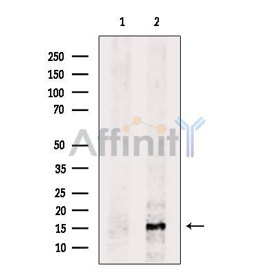 CYB5 Antibody - Western blot analysis of extracts from B16F10 cells, using CYB5 Antibody.