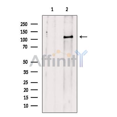 Phospho-MYPT1 (Thr853) Antibody - Western blot analysis of extracts from HUVEC cells, using Phospho-MYPT1 (Thr853) Antibody.