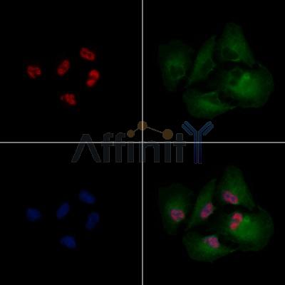 C-RAF Antibody - AF6065 staining A549 cells cells by IF/ICC.