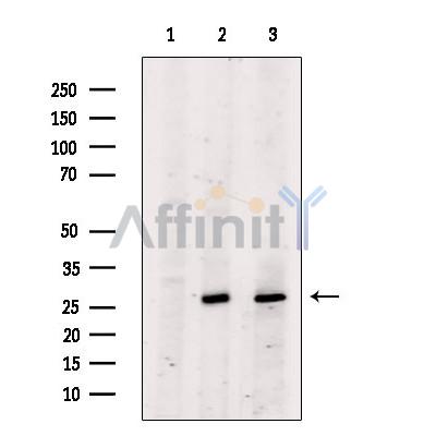 Bcl-2 Antibody - Western blot analysis of extracts from various samples, using BCL-2 Antibody.