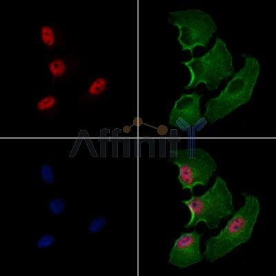 Smad2 Antibody - AF6449 staining A549 cells by IF/ICC.
