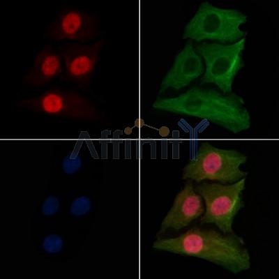 macroH2A.1 Antibody - DF13300 staining HepG2 cells(30min of 4uM Forskolin treatment) by IF/ICC.