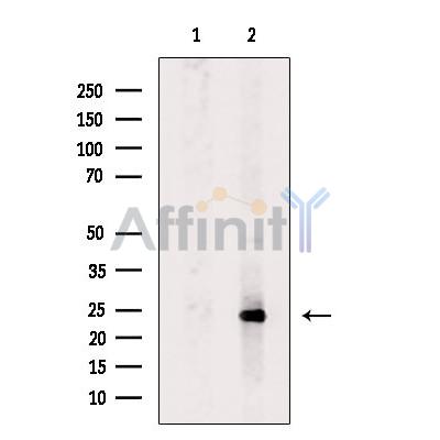 PSMD10 Antibody - Western blot analysis of extracts from MCF7 cells, using PSMD10 Antibody.