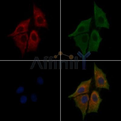 NLRP3 Antibody - DF7438 staining HepG2 cells(30min of 4uM Forskolin treatment) by IF/ICC.