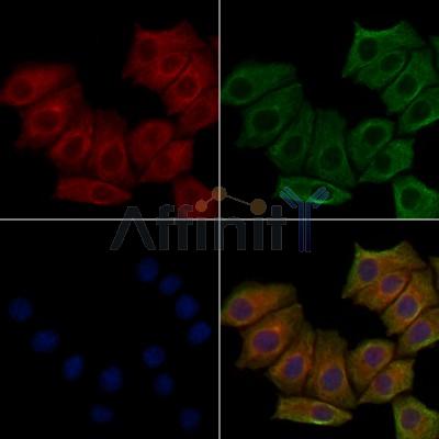 MUC16 Antibody - DF7989 staining HepG2 cells(30min of 4uM Forskolin treatment) by IF/ICC.