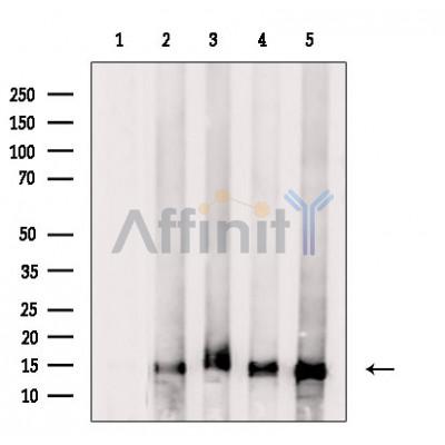 Histone H2B Antibody - Western blot analysis of extracts from various samples, using Histone H2B Antibody.