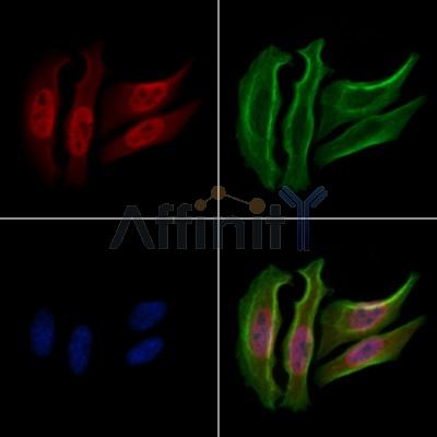 Phospho-Hsp90 beta (Ser254)[Ser255] Antibody - AF3126 staining Hela cells(20min of 30uM Forskolin treatment) by IF/ICC.