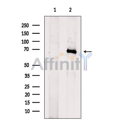NF-kB p65 Antibody - Western blot analysis of extracts from HUVEC cells, using NF-kappaB p65 Antibody.
